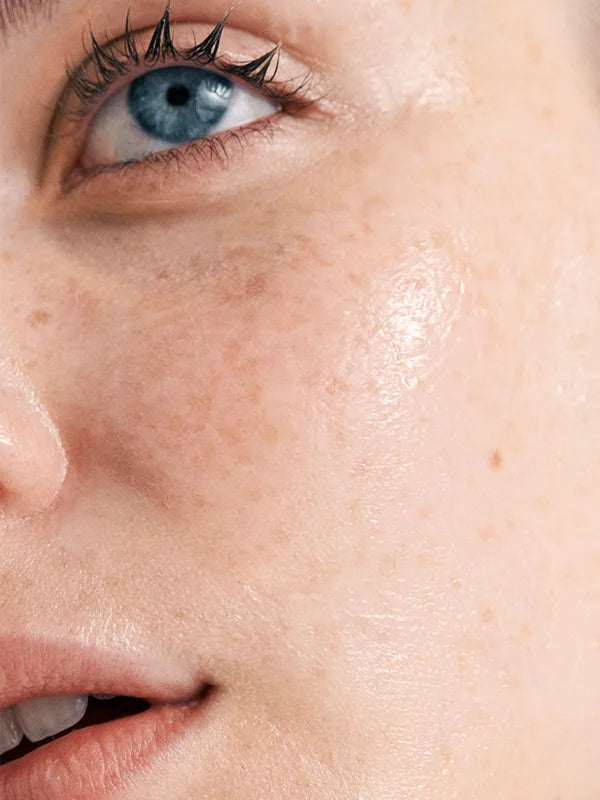 Combatting Dry Skin While Flying: Tips and Tricks from a Flight Attendant